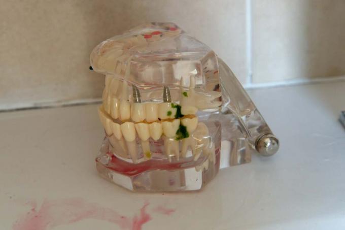 Philips Sonicare DiamonClean 3rd Generation - prueba de dientes espinaca