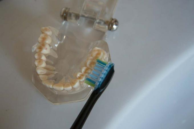 Philips Sonicare DiamondClean 3rd Generation: prueba de dientes